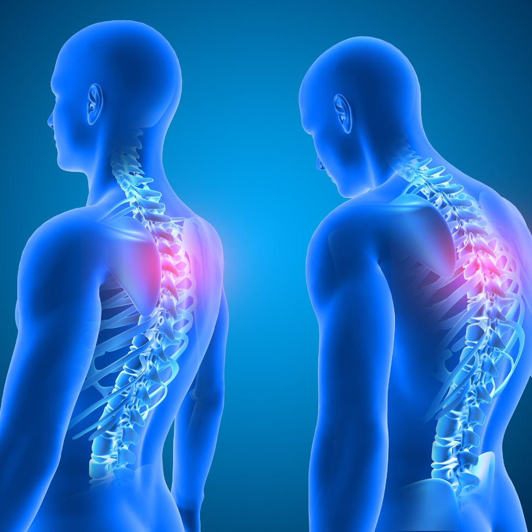 3d human model with their spin showing and glowing red