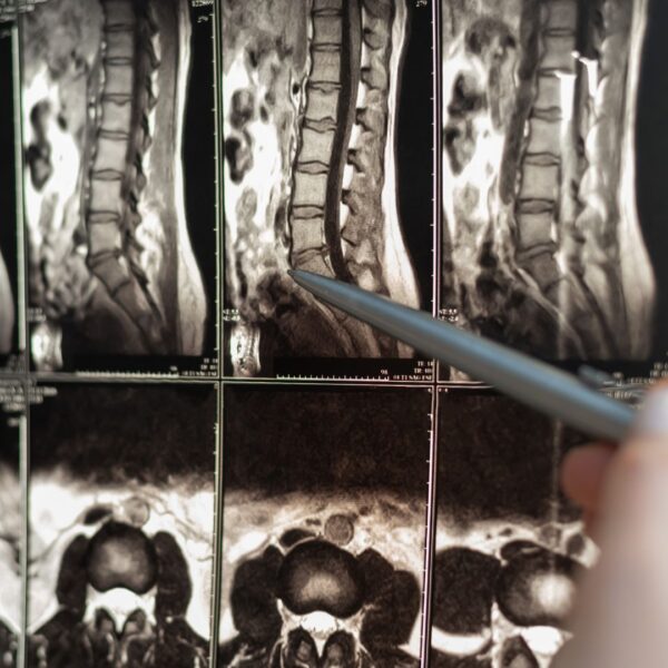 xray