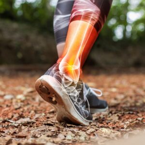 a injured ankle while running