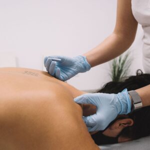 dry needling on patient's back