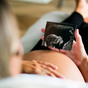 Pregnant woman looking at a sonogram while holding her belly.