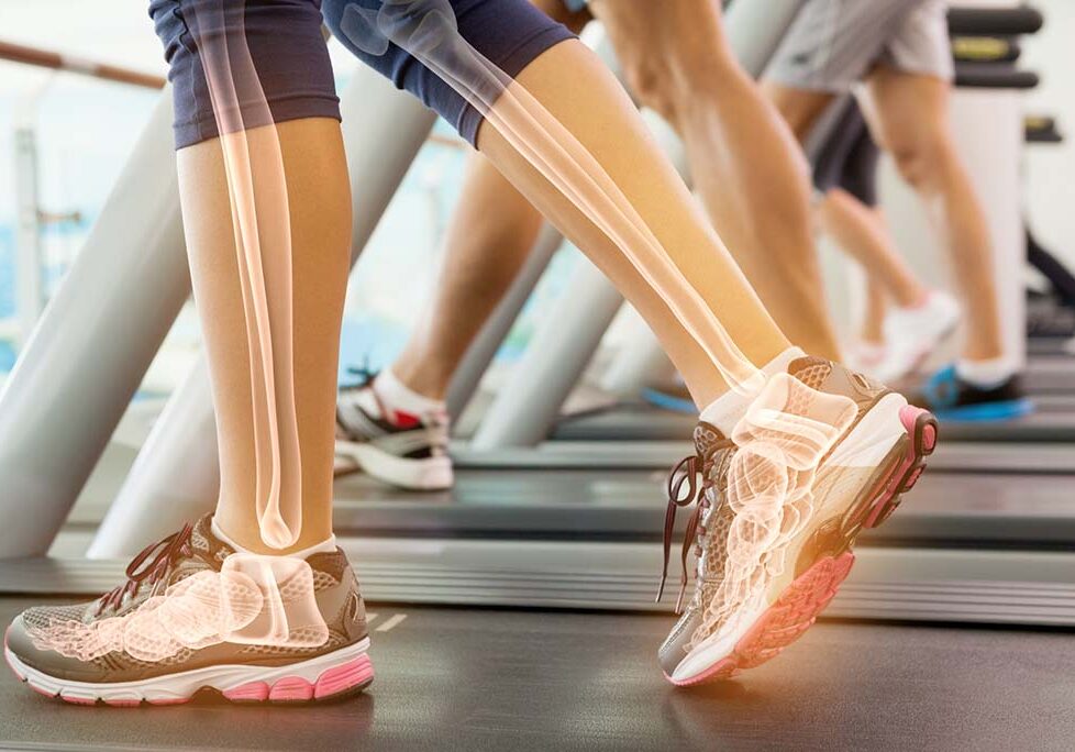 legs showing xray of bones on treadmill